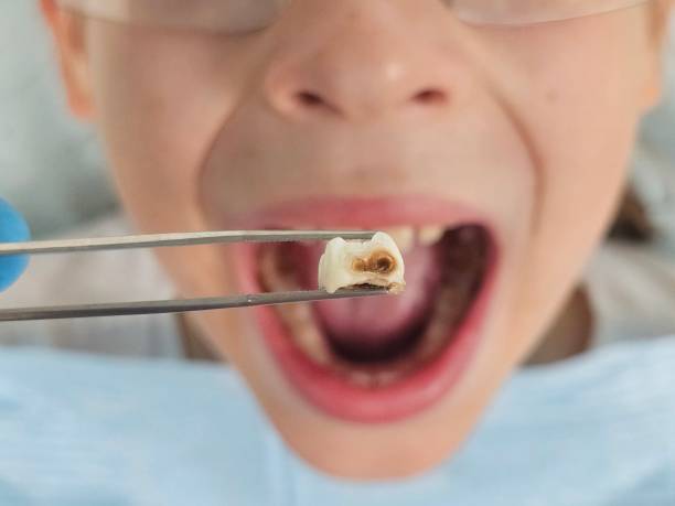 Best Emergency Denture Repair in Groveland, FL